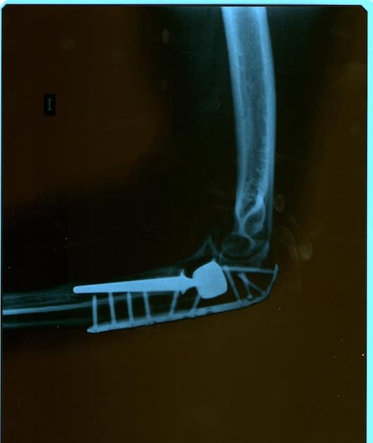 An MRI scan showing a severe injury to the athlete's knee or spine. The image is contrasted with a photo of the athlete in peak physical condition before the injury.